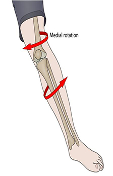 ACL Injury