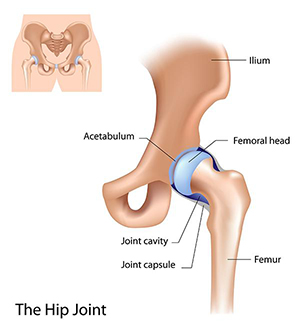 Hip Fracture